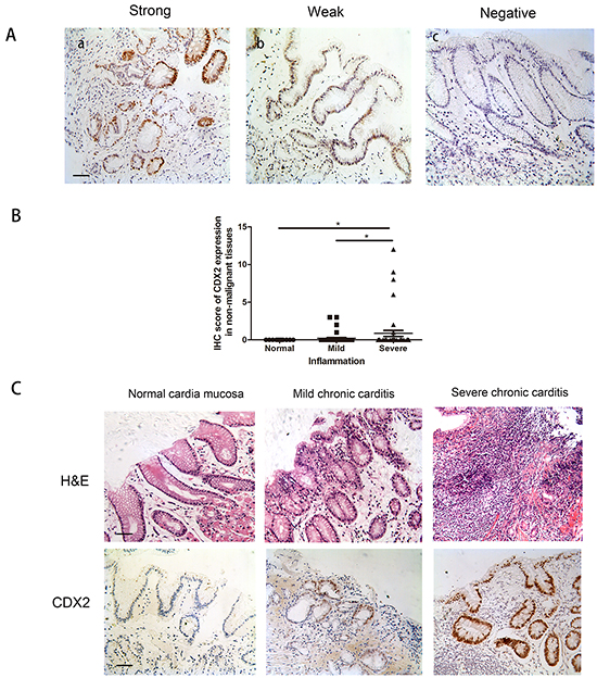 CDX2 expression in non-malignant gastric cardia tissues.