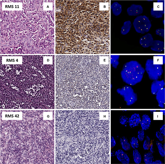 Protein an genetic status of ALK.