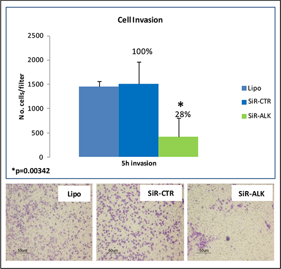 ALK silencing: siRNA-mediated down-modulation of ALK significantly inhibited invasion capability of RH30 cells.