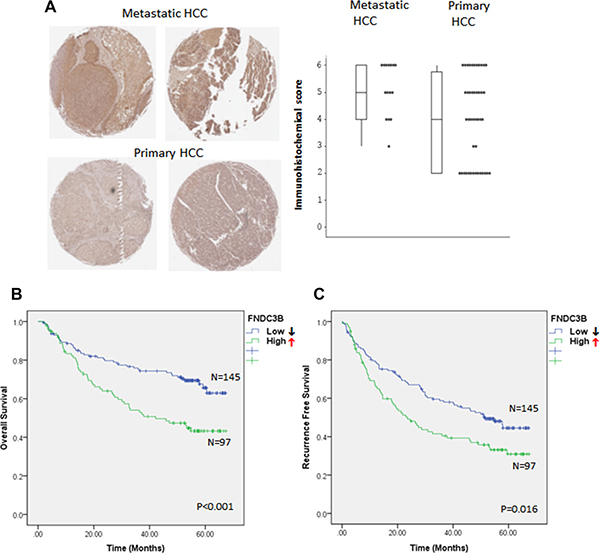 FNDC3B overexpression correlates with HCC metastasis and patient survival.