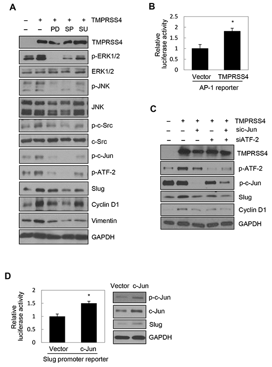 JNK signaling activity and c-Jun/ATF-2 were required for TMPRSS4-mediated Slug and cyclin D1 induction.