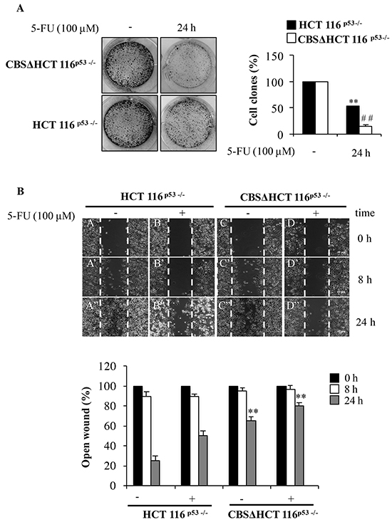 Depletion of CBS decreases cell proliferation and migration.