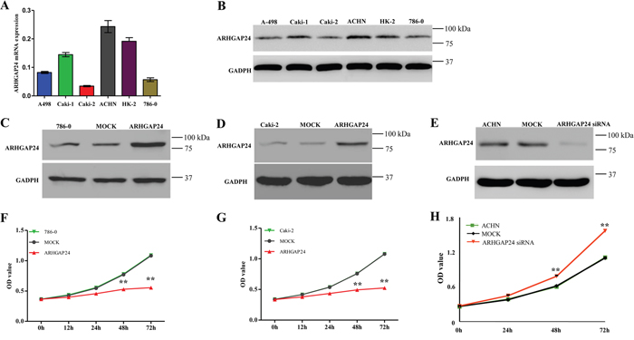 ARHGAP24 inhibits cell growth of renal cancer cells.