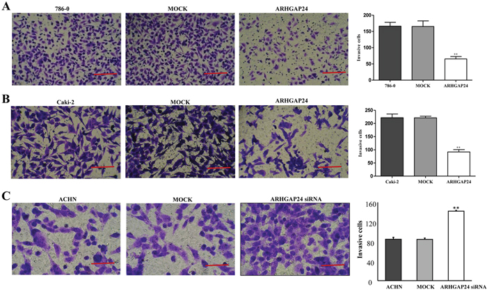 ARHGAP24 decreases cell invasion in renal cancer cells.