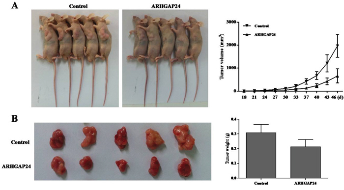 Over-expression of ARHGAP24 in renal cancer cells reduces tumor growth in vivo.