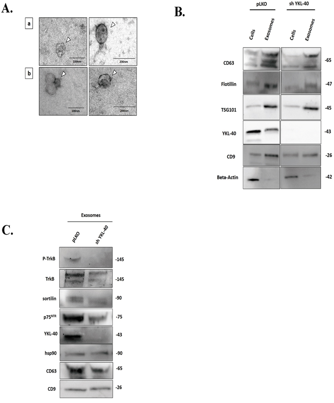 Composition of neurotrophin receptors in exosomes purified from pLKO and sh YKL-40 cells.