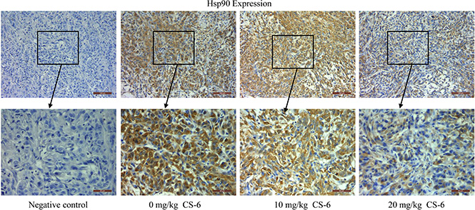 Immunohistochemical analysis of Hsp90 expression in tumor samples.