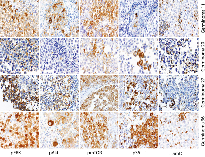 Representative staining results of pERK, pAkt, pmTOR, pS6 and 5mC.