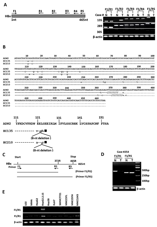 Detection of full-length and C-terminal truncated forms of HBx DNA in human HCC samples and mRNA in human hepatoma cell lines.