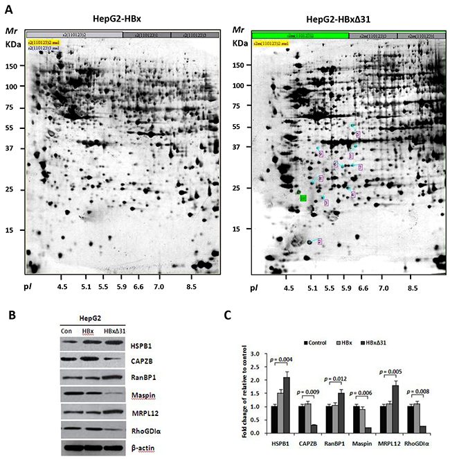 HBx&#x0394;31 deregulates the metastasis-related proteins in HepG2 cells.
