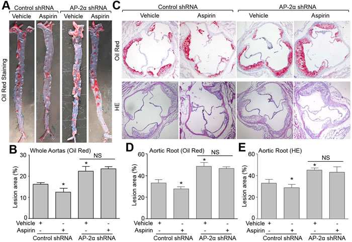 Deficiency of AP-2&#x3b1; abolishes the suppressive effects of aspirin on aortic atherosclerotic lesion development in