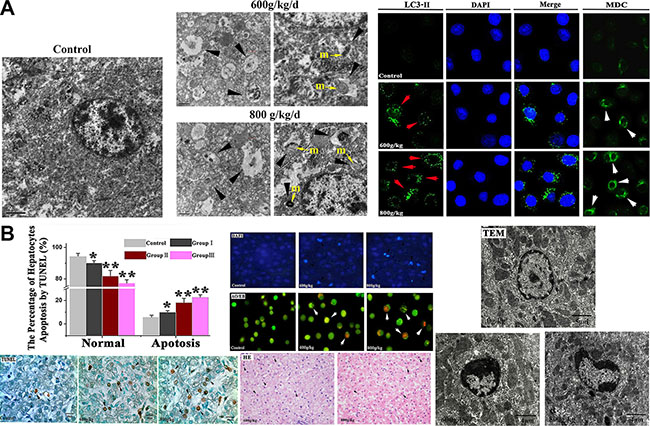 The Morphological changes of autophagy and apoptotic hepatocytes induced by E. adenophorum.