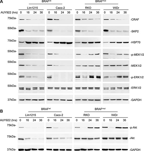 Resistance of mutant BRAF colon cancer cells to AUY922 is associated with rapid recovery of ERK and Akt activation .