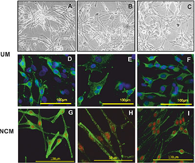 Representative images of UM and NCM cells in culture.