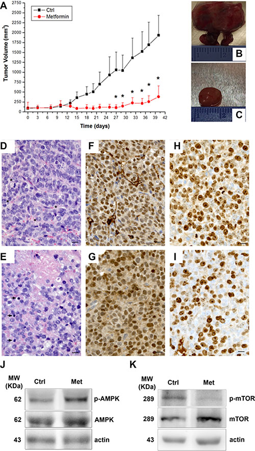 Metformin inhibits tumor growth in a mouse xenograft model of ACC.