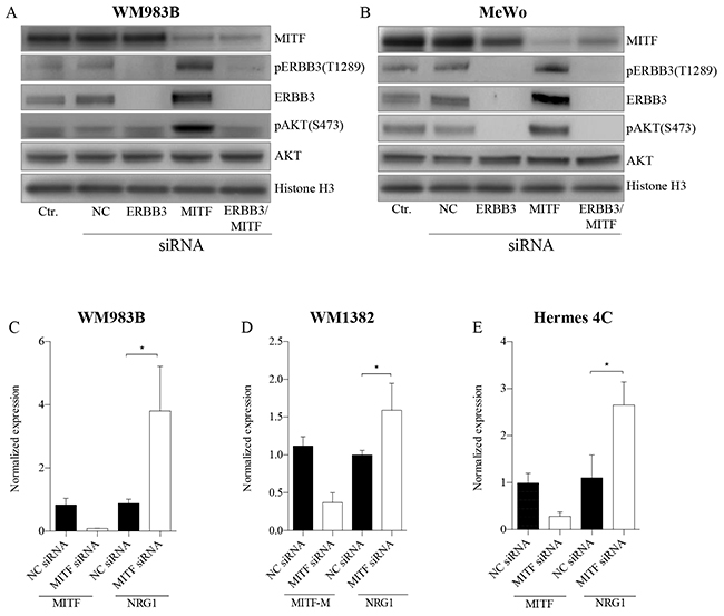 MITF suppress the PI3K-pathway through NRG1-beta/ERBB3 signaling.