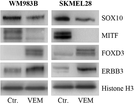 Vemurafenib treatment results in loss of MITF and gain of FOXD3 and ERBB3.