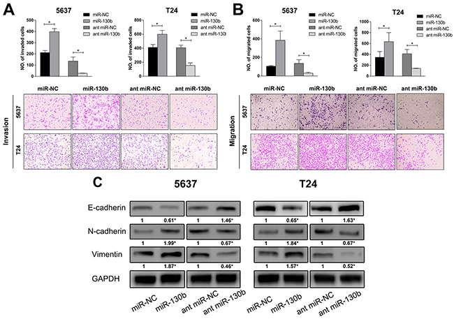 miR-130b stimulated the invasion and migration of TCC cells and induced epithelial mesenchymal transition (EMT) of cells.