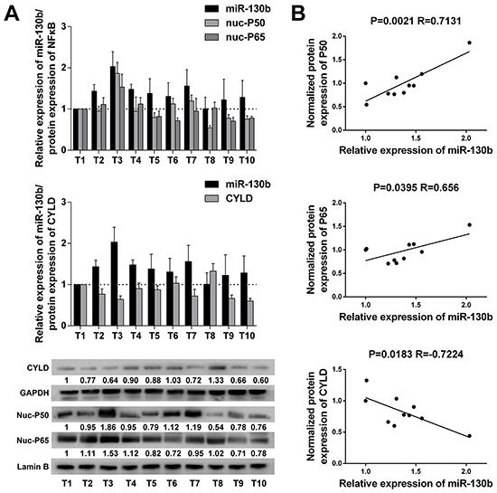 miR-130b expression was positively correlated with NF-&kappa;B activation and inversely correlated with CYLD protein expression in bladder tumor samples.