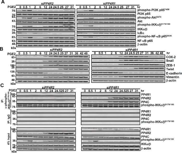 Knockdown of PP4R2 decreases the association of PP4C to phospho-IKK and enhances IKK/NF-&#x03BA;B signaling, COX-2 and Snail.