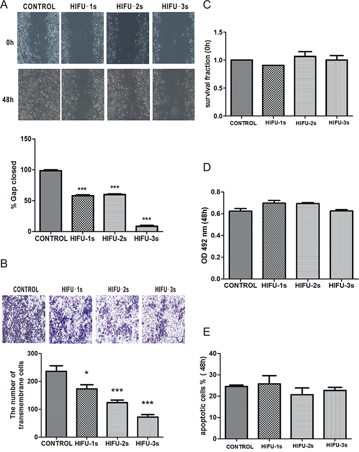 HIFU exposure inhibited migration in B16-F10 cells.