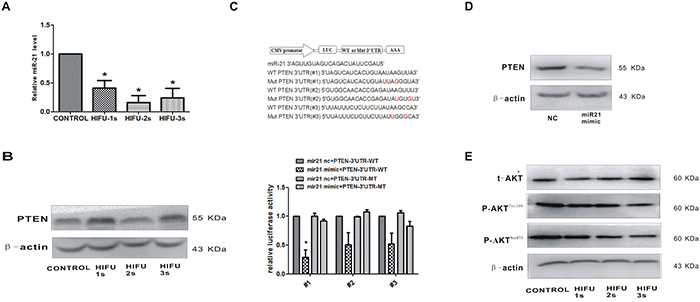 HIFU exposure decreased miR-21 expression and increased its target gene PTEN in B16-F10 cells.