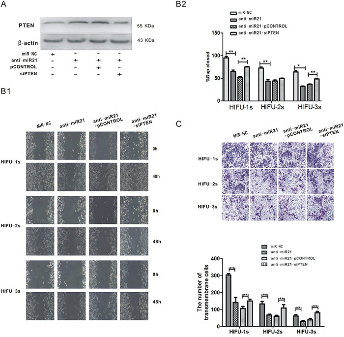 The decrease of miR-21 inhibited the migration of B16-F10 melanoma cells through up-regulation of PTEN after HIFU exposure.