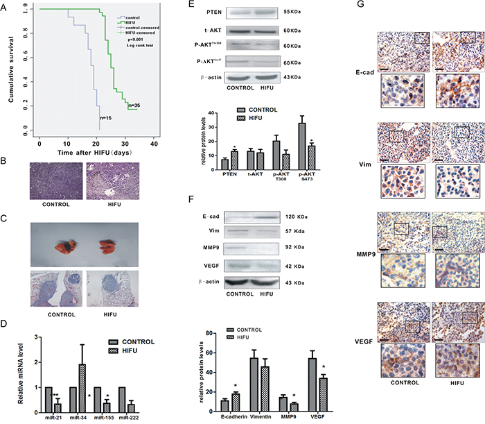 HIFU exposure suppressed melanoma metastasis and down-regulated miR-21 expression in vivo.