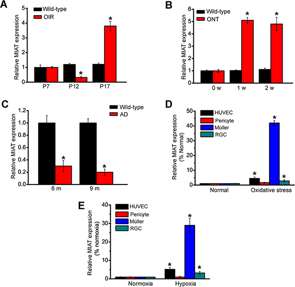 MIAT is aberrantly expressed during neurovascular dysfunction.