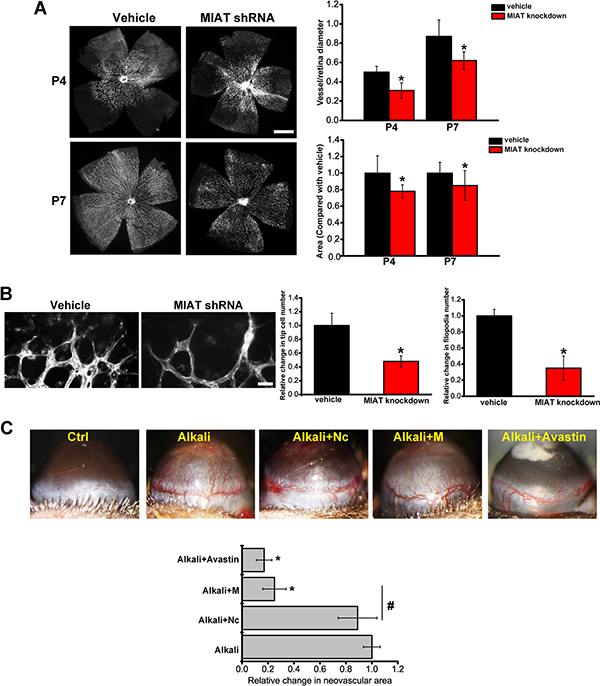 MIAT is an important regulator of vascular remodeling.