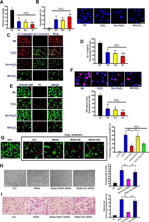 MIAT regulates the function of neurovascular unit in vitro.