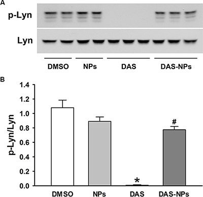 Effects of DAS and DAS-loaded NPs on Lyn signaling in HPAECs.