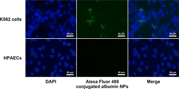 Uptake of albumin NPs by K562 and HPAECs.
