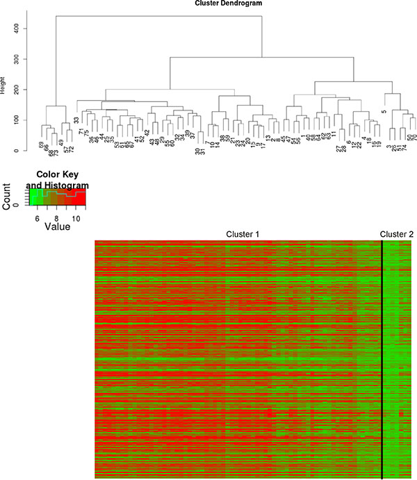 Molecular classification of IMP2 overexpressing samples.