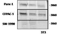 Figure2: LH-RH receptor protein (38 kD) was detected by Western blotting in three human pancreatic cancer lines grown in nude mice.
