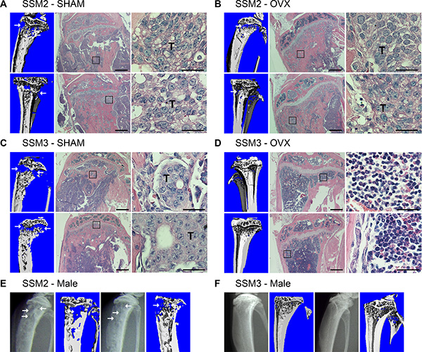 ER&#x03B1;+/PR+ SSM2 but not SSM3 cells grow in bone independent of ovarian hormones.