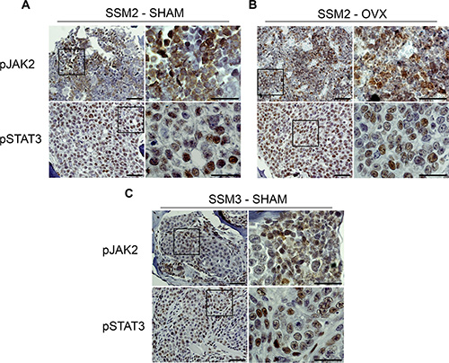 Bone residing SSM2 and SSM3 cells express pJAK2 and pSTAT3.