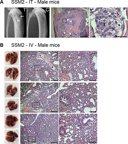 ER&#x03B1;+/PR+ SSM2 cells establish bone but not lung metastasis in male mice.