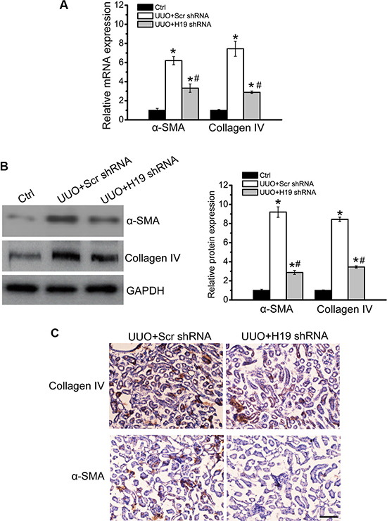 LncRNA-H19 knockdown inhibits renal fibrosis in vivo.