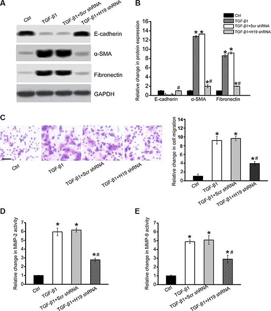 LncRNA-H19 knockdown affects renal cell function and inhibits renal fibrosis in vitro.