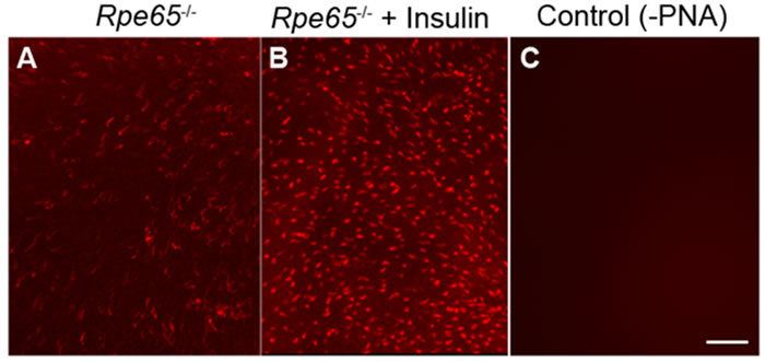 Insulin delays the death of cone photoreceptors in