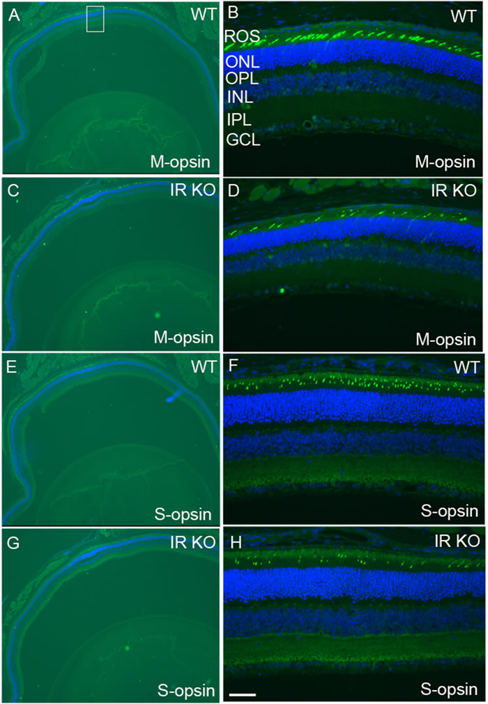 Loss of M- and S-cones in IR KO mice.