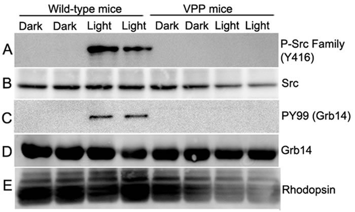 Loss of Src activation and Grb14 phosphorylation in VPP-transgenic mice.