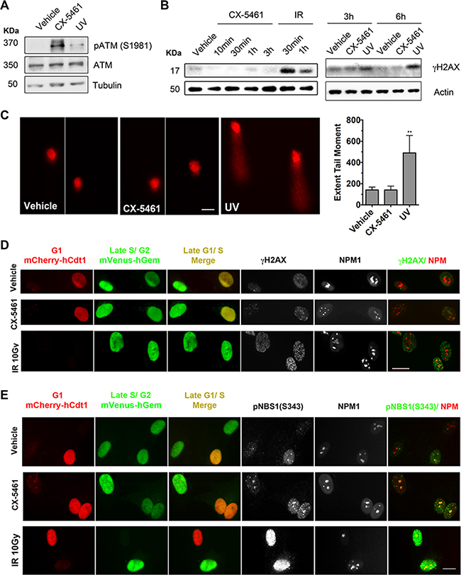 CX-5461 activates ATM signaling within the nucleoli in the absence of DNA damage.