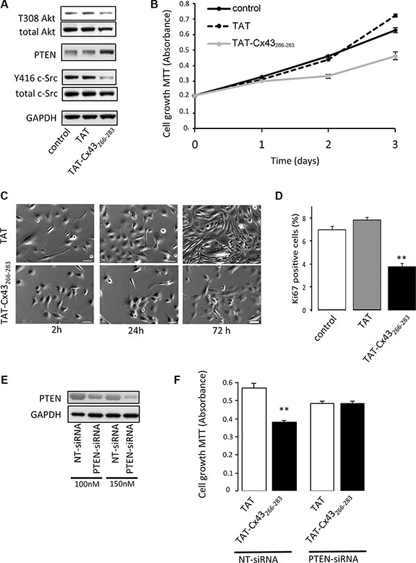 Involvement of PTEN in the antiproliferative effect of TAT-Cx43-266-283 on G166 human glioblastoma stem cells.