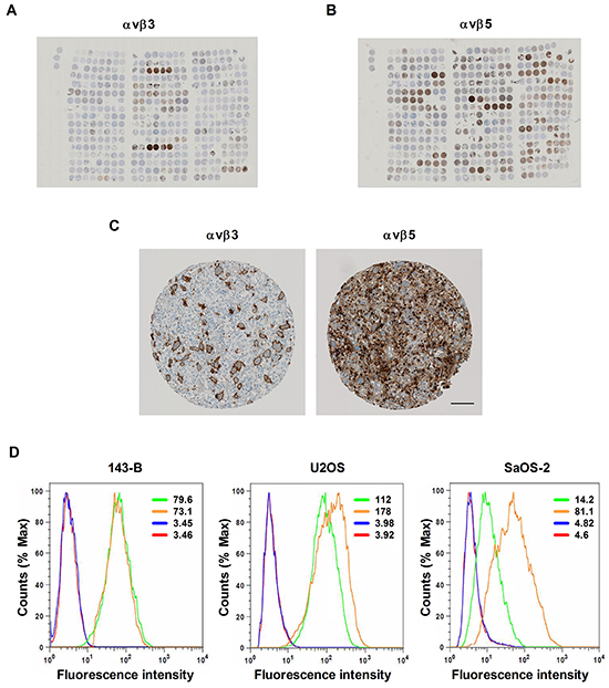 Expression of &#x03B1;v&#x03B2;3 and &#x03B1;v&#x03B2;5 integrins in human osteosarcoma tissue arranged on a tissue microarray and in established human osteosarcoma cell lines.