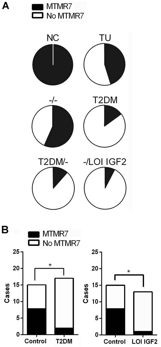 Loss of MTMR7 protein is a common event in human CRC.