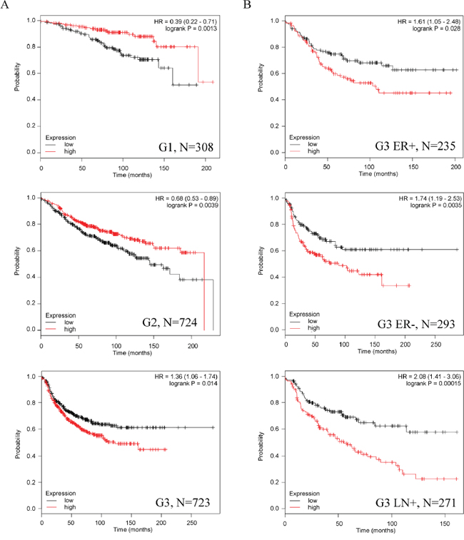 Asporin expression has different prognostic value in low-grade and advanced breast cancer.