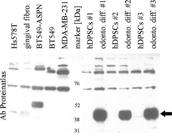 Validation of asporin antibody (Proteinatlas #HPA008435) in breast cancer cells, gingival fibroblasts and human dental pulp stem cells (hDPSCs).