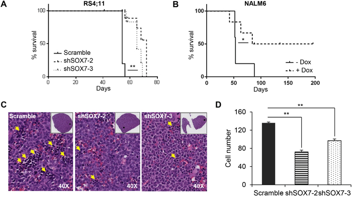 The down-regulation of SOX7 expression in BCP-ALL cells decreases leukemogenesis burden.
